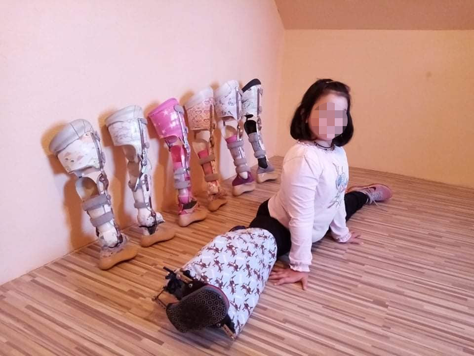 NEMA NOGE, A MOŽE „ŠPAGU“: Hrabra djevojčica (7) iz Šamca plijeni optimizmom
