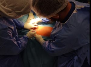USPJEH TIMA UKC-a: Ugrađen vještački kuk operacijom za bezbolni oporavak