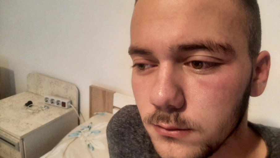 JOŠ JEDAN SRPSKI MLADIĆ NAPADNUT NA KOSOVU I METOHIJI