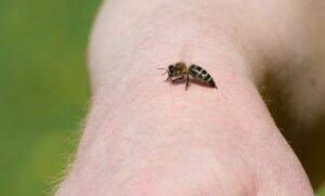 NA IZLETU VAS JE UBOLA PČELA? Evo šta se preporučuje da uradite odmah