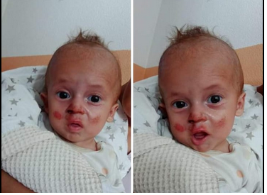 POMOZIMO MALOM ADEMU: Dječak iz Velike Kladuše boluje od teške bolesti (FOTO)