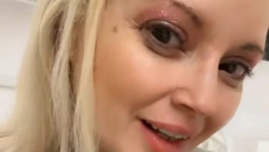 „GIPS DO KOLJENA“: Maja Nikolić doživjela nezgodu (FOTO)