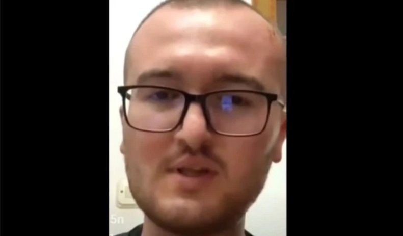 SNIMAK UŽASNUO SVIJET: Momak koji je preživio požar u Kočanima pokazao svoje rane (VIDEO)