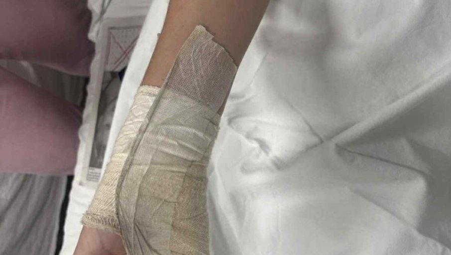 DJEČAKU (14) IZ NIŠA AMPUTIRAN DIO PRSTA: Majka tvrdi da su ga pretukli huligani na ulici