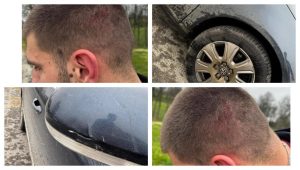 NA JEDNOG NJIH 10: Blokaderi napali aktivistu SNS-a (VIDEO)