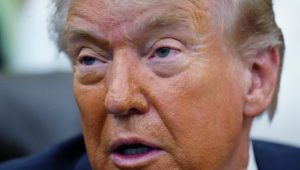 ПРЕДСЈЕДНИК АМЕРИКЕ ИМА ОТОК И МОДРИЦЕ ПО ТИЈЕЛУ? Хитно се огласио Трампов љекар са важним информацијама