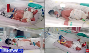 FENOMEN U AUSTRALIJI: Žena rodila četvorke začete iz jedne oplođene jajne ćelije (VIDEO)